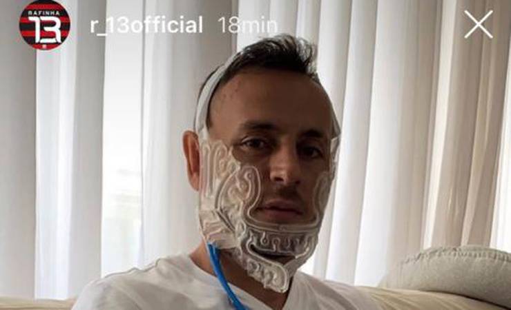 Rafinha inicia tratamento no CT do Flamengo e posta foto enigmática
