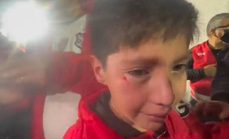 'Vi meu filho caído e sangrando', diz mãe de menino atingido por sinalizador em Flamengo x Católica