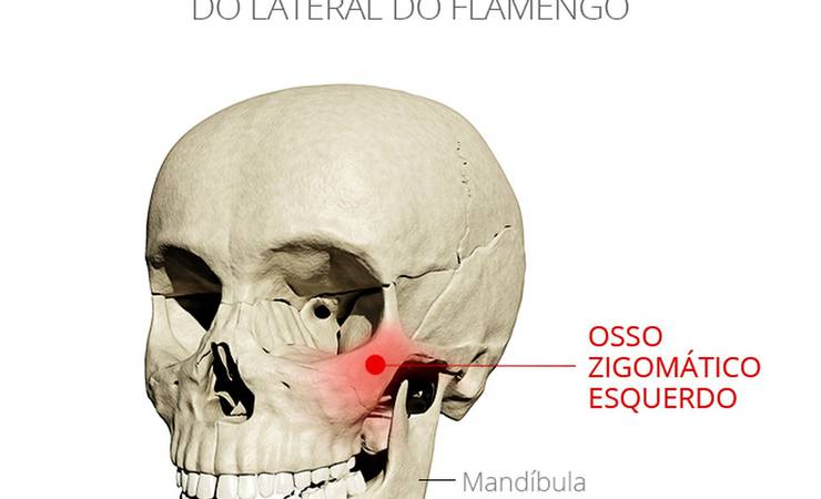 Cirurgia de Rafinha é bem-sucedida, e lateral do Flamengo se reapresenta na quinta-feira